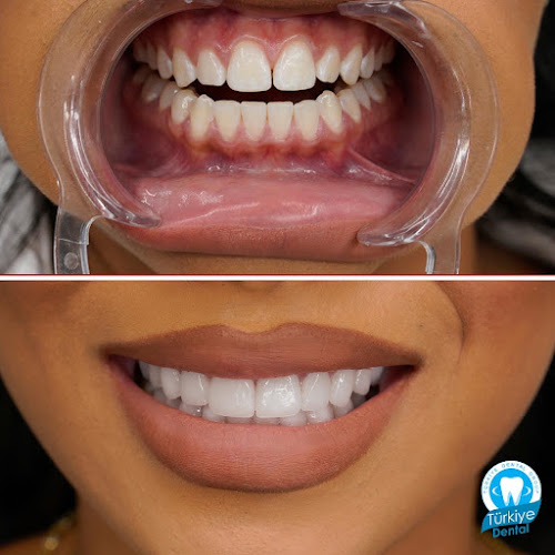 Türkiye Dental