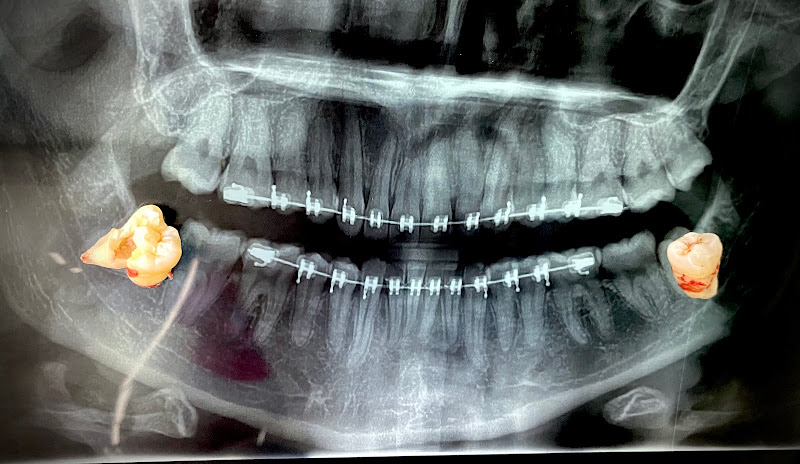 Dra. Fernanda Trejo, CIRUGÍA BUCAL E IMPLANTES