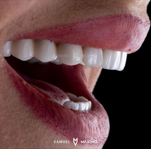 Clínica Samuel Máximo Dentista 24 Horas Urgencias Dentales