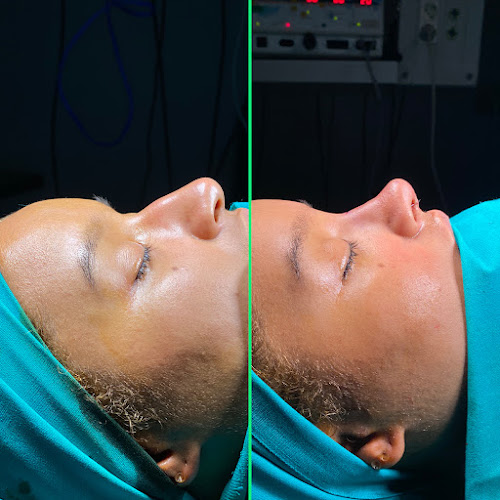 Vivid Clinic | Cosmetic Surgery Istanbul, Turkey